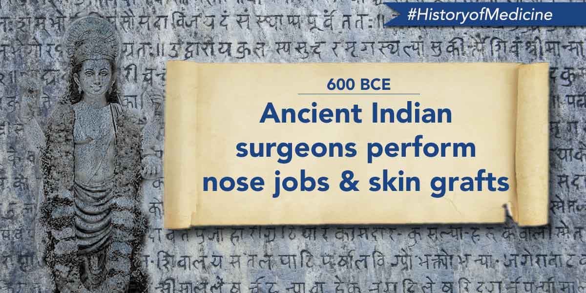 Columbia University says plastic surgery first performed in ancient India